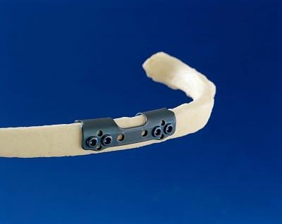 rib repair plate