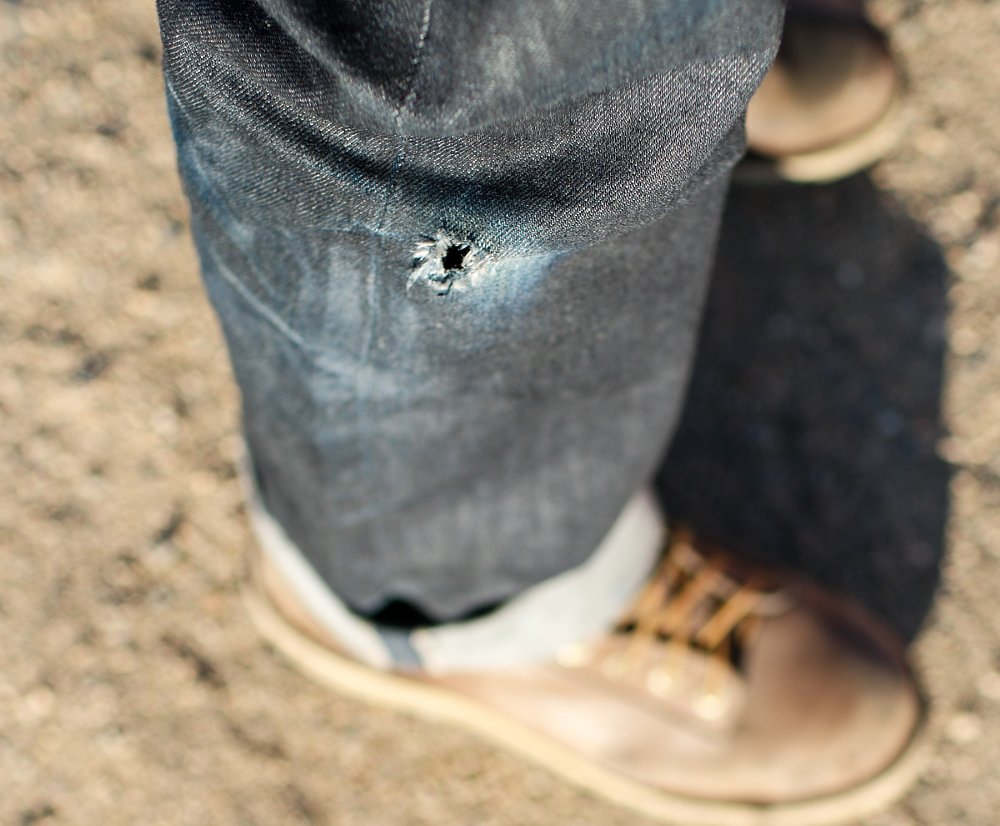 damage to pants