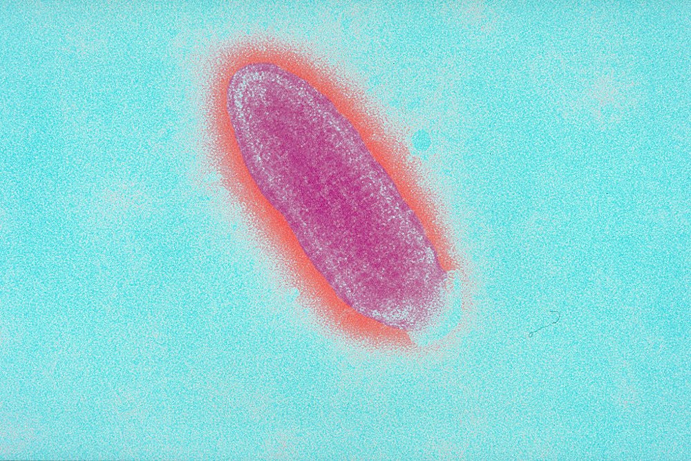 rabies virus